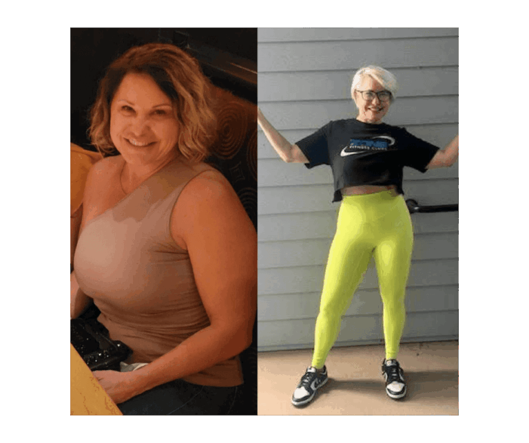 Before and After Pictures