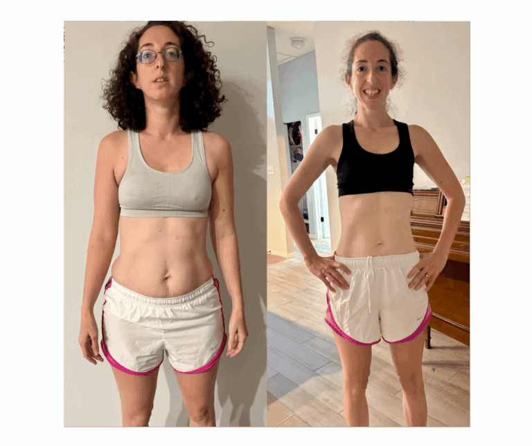 Before and After Pictures