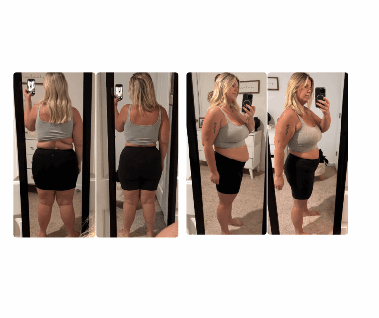 Before and After Pictures