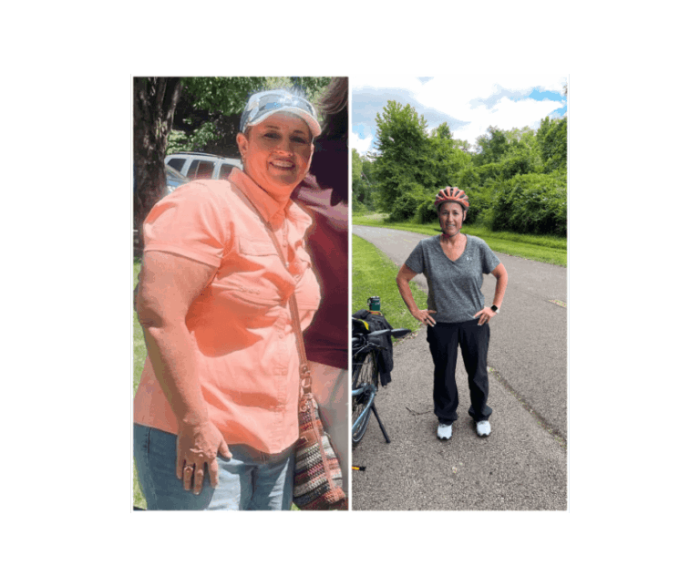 Before and After Pictures